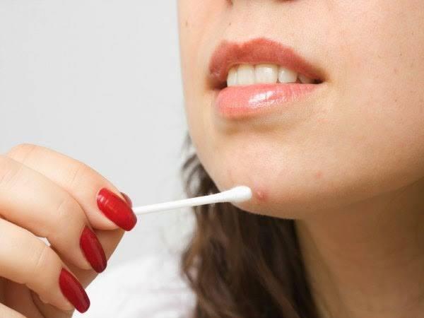 Cách trị mụn triệt để theo từng vị trí trên mặt