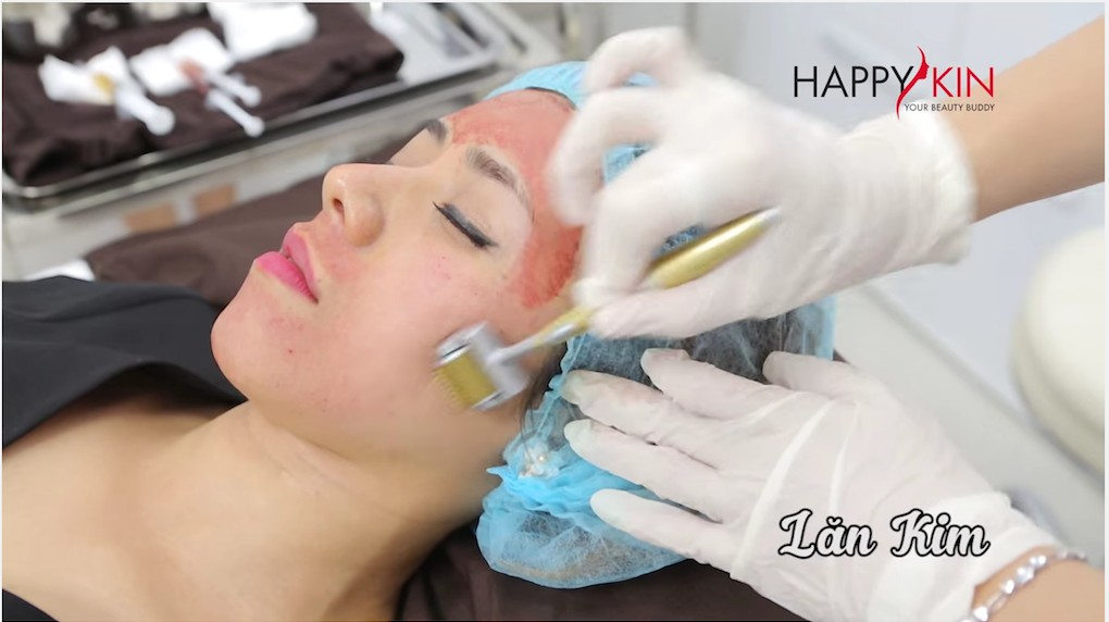 Công nghệ lăn kim: Liệu pháp mới nhất để giải quyết tất cả các vấn đề của da bạn?