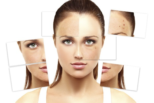 Từ vựng về da phổ biến nhất bạn cần biết (Phần 2)