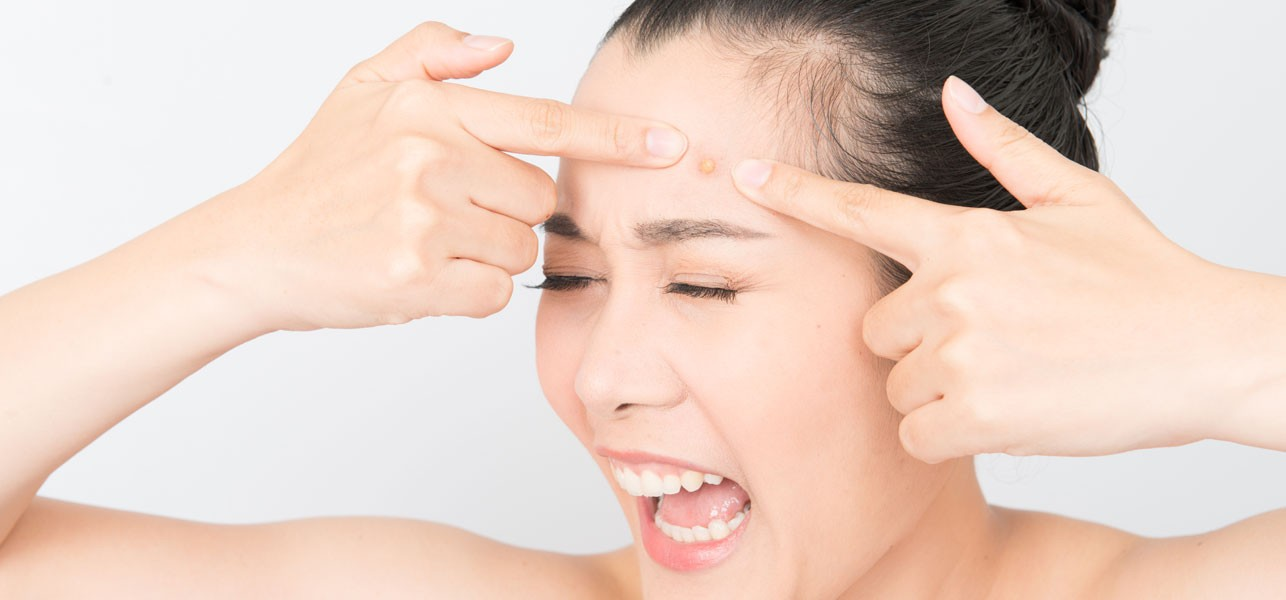 Chia Sẻ Kinh Nghiệm Điều Trị Mụn Nội Tiết Tố Thành Công