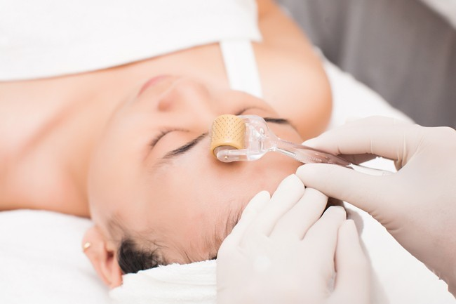 Hướng Dẫn Chi Tiết Cách Chăm Sóc Da Sau Khi Lăn Kim