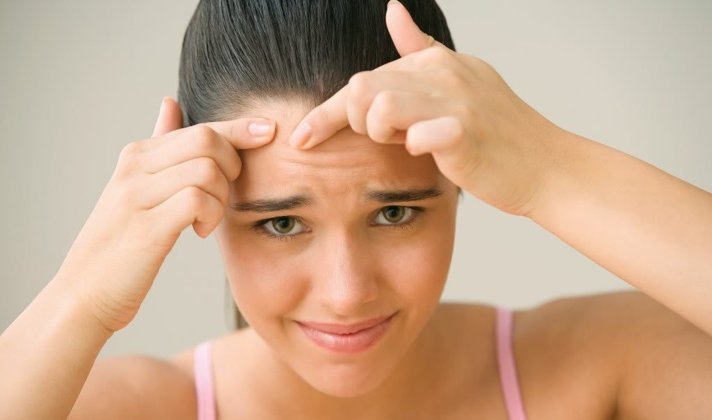 Hướng Dẫn Cách Ngăn Ngừa & Điều Trị 7 Loại Mụn Khác Nhau