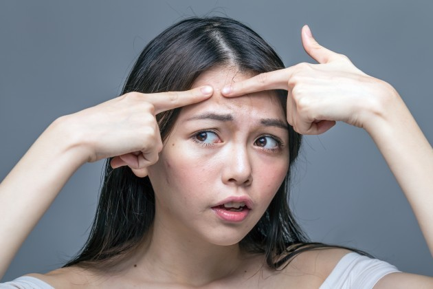Chia Sẻ Kinh Nghiệm Xử Lý Mụn Viêm Sưng Lớn Cấp Tốc Chỉ Trong Vài Ngày