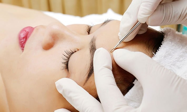 Tổng hợp các địa điểm NẶN MỤN ở Sài Gòn được nhiều chị em chia sẻ nhất