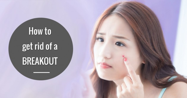 Beauty Blogger chia sẻ cách xử lý và chăm sóc da trong & sau khi breakout