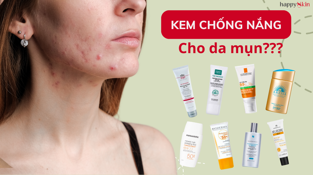 Nàng da MỤN tuyệt đối không thể bỏ qua 8 kem chống nắng này