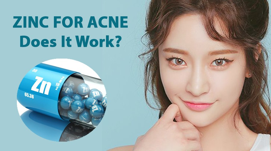 Uống Kẽm Trị Mụn Nội Tiết Có Hiệu Quả? Hãy Lắng Nghe Chuyên Gia Giải Đáp Ngay
