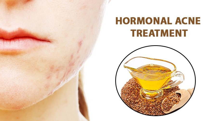 Hướng dẫn trị mụn nội tiết bằng dầu hạt lanh flaxseed oil