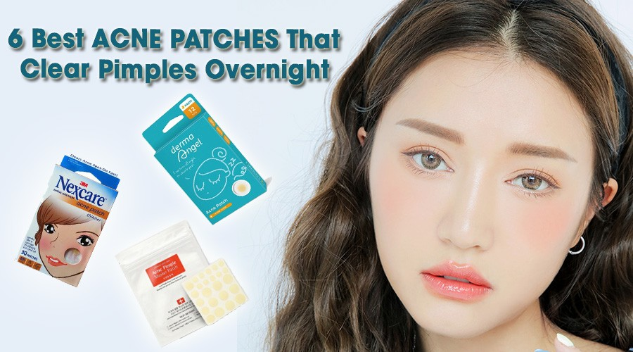Mụn sưng to chỉ là “chuyện nhỏ” với 6 miếng dán trị mụn thần thánh này