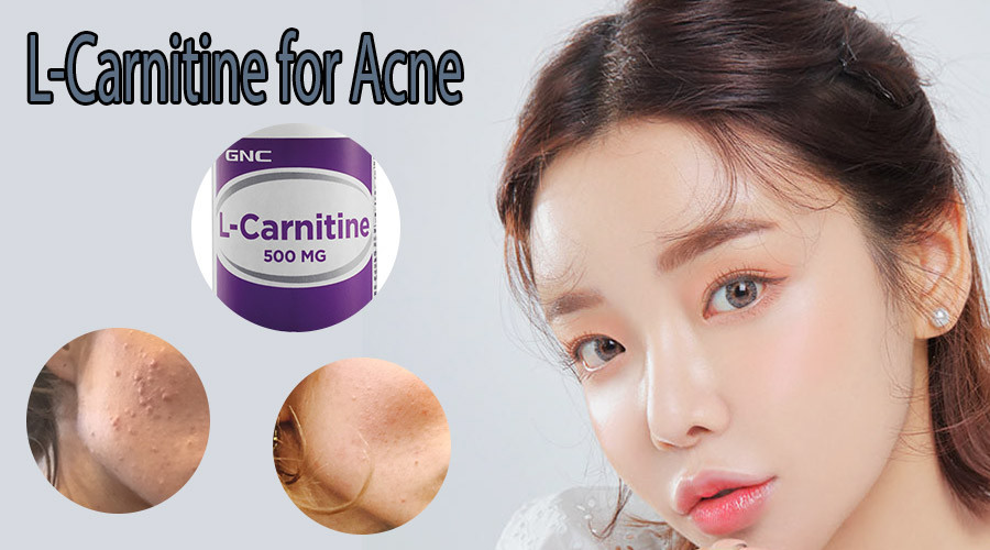 l carnitine có tác dụng gì Fat Dissolving Lemon Bottlechin Before and After main image 1