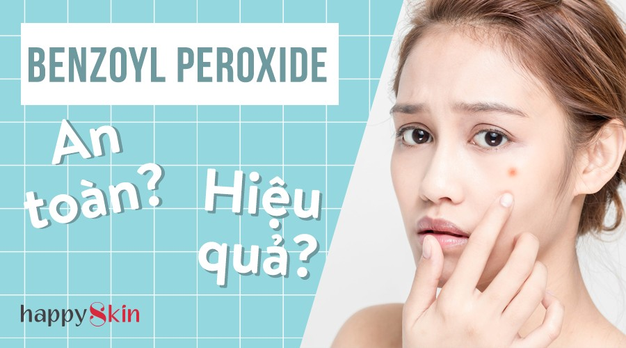 Lợi và hại khi dùng Benzoyl Peroxide trị mụn