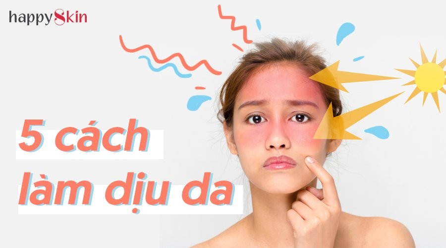 Làm mát và dịu da tức thì sau khi đi nắng chỉ với 5 cách đơn giản này