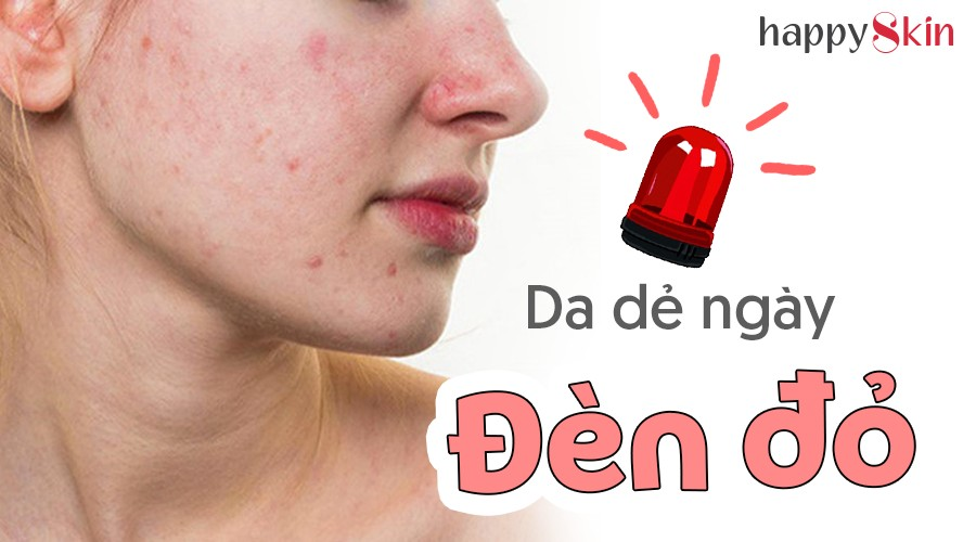 Làn da bạn thay đổi ra sao Trước và Sau ngày “đèn đỏ”
