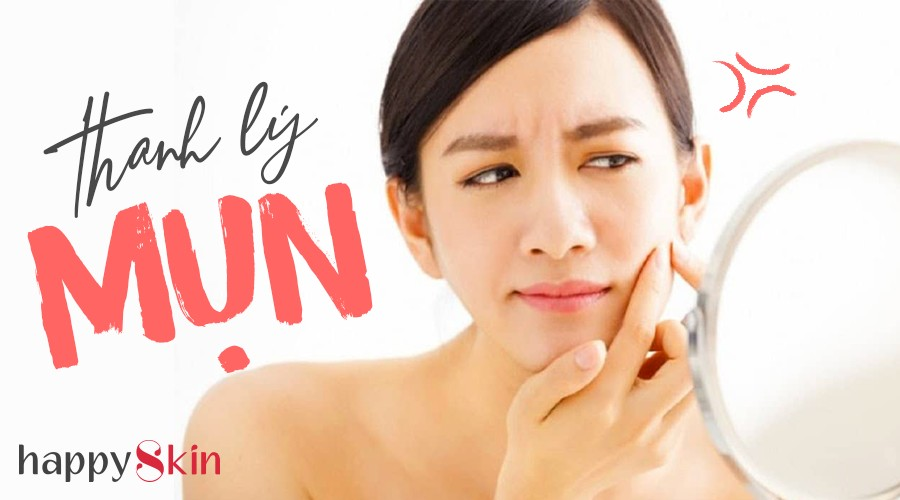 Nhắc nhở bản thân: Lấy mụn chứ đừng nặn mụn