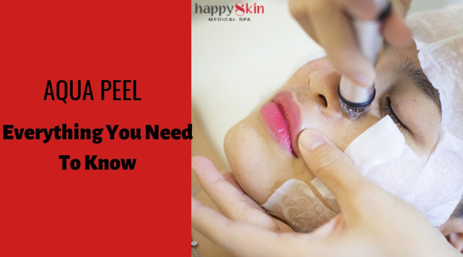 Những điều cần biết về Aqua Peel