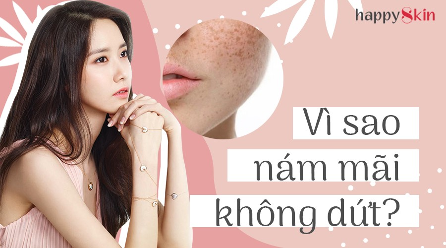 Tại sao nám da, tàn nhang, đốm nâu mãi không dứt?