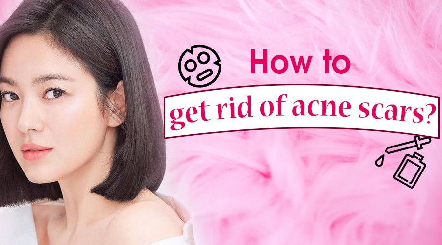 Trước ngày hẹn hò, da nổi mụn thì phải làm sao?