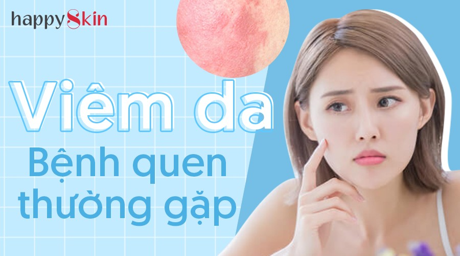 Viêm da – Bệnh quen thường gặp mà không phải ai cũng biết cách trị