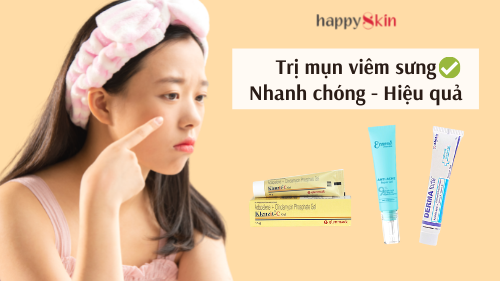 3 bước trị MỤN VIÊM SƯNG chỉ sau vài ngày