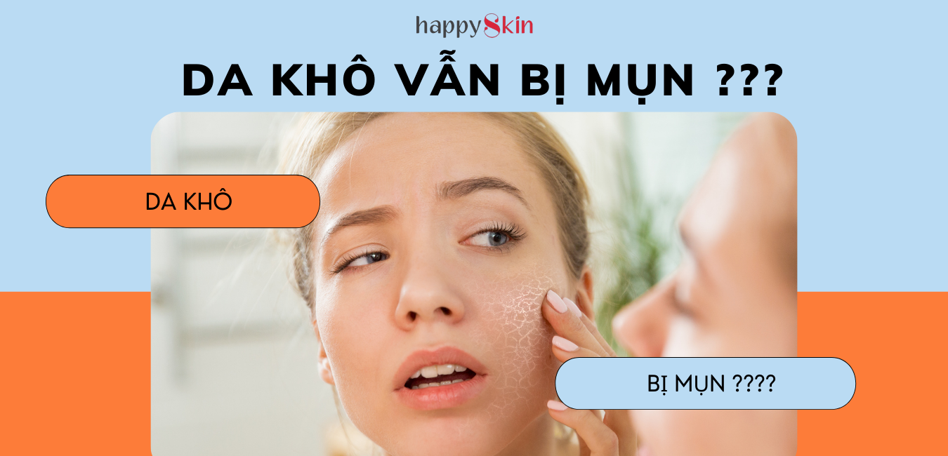 Vì sao Da Khô nhưng vẫn BỊ MỤN?