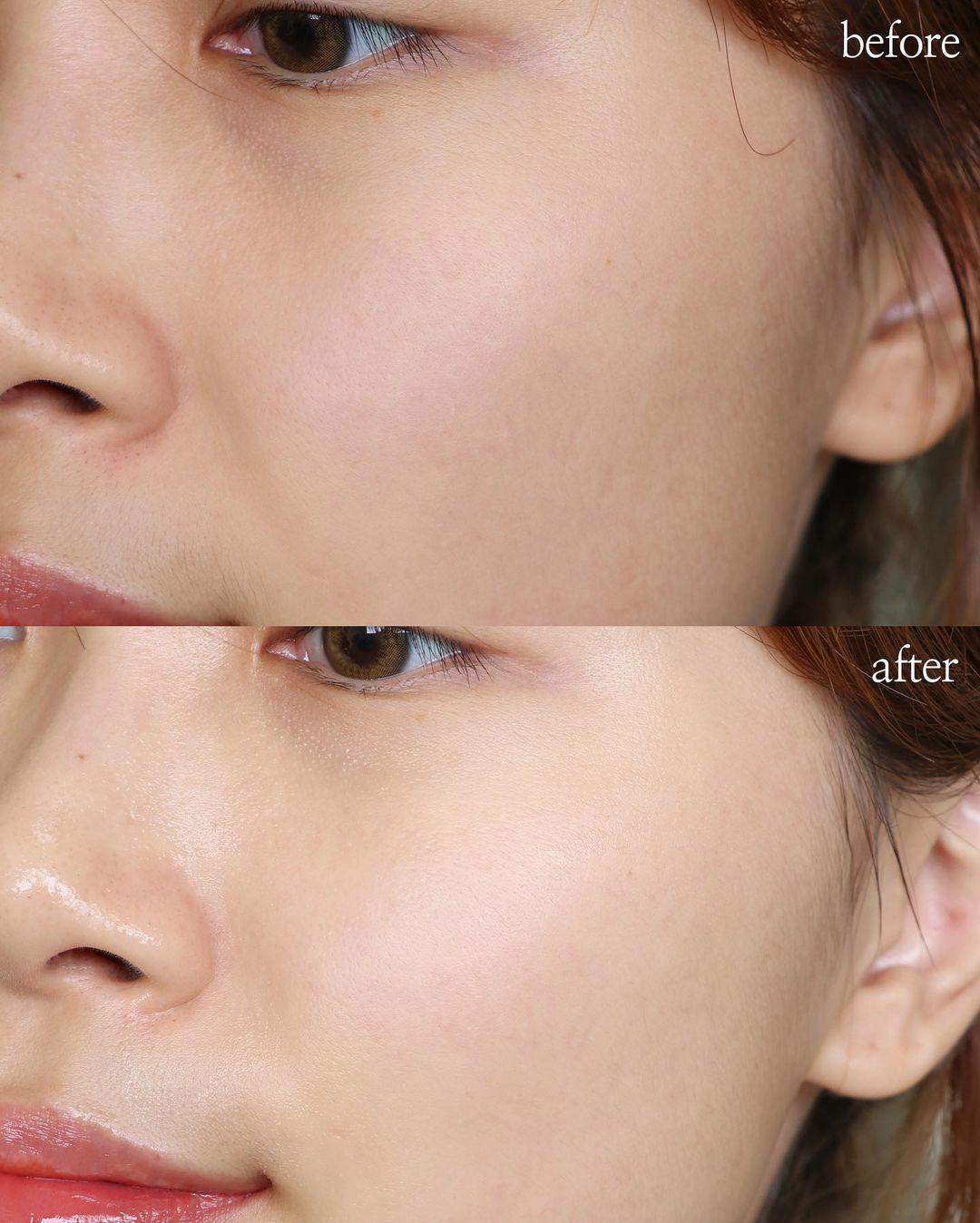 Niacinamide và Vitamin C đều giúp làm sáng da