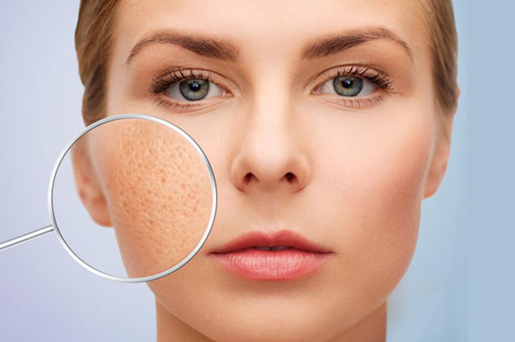 Emmié Face & Body Ice Cooler: Giải pháp thu nhỏ lỗ chân lông hoàn hảo