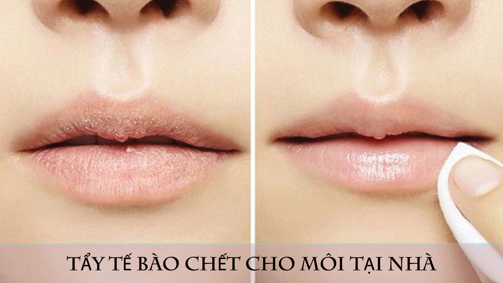 10 Cách Tẩy Tế Bào Chết Cho Môi Tại Nhà Cực Kì Đơn Giản Tại Nhà