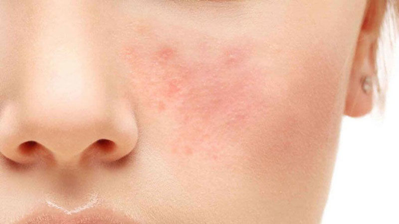 Hướng Dẫn Cách Dưỡng Da ORPW Sáng Tối Đúng Chuẩn