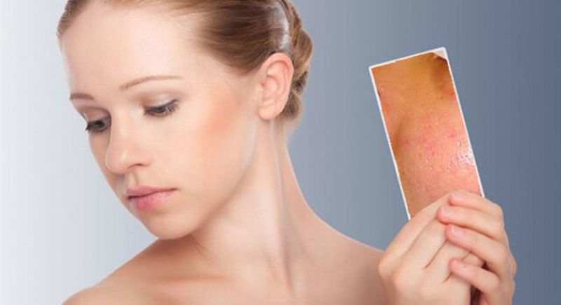 Một số thành phần không nên có trong mỹ phẩm dành cho da ORPW