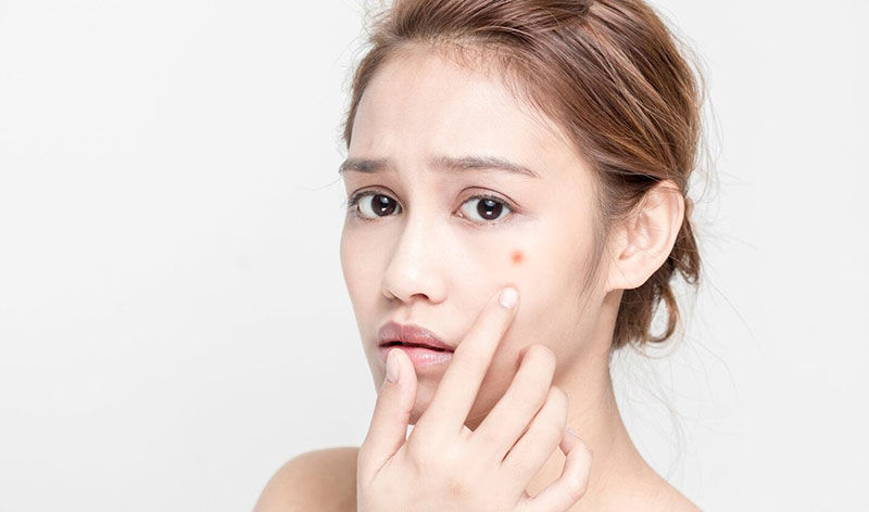 Bật mí hướng chăm sóc cho làn da OSPT