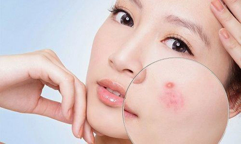 Cải thiện làn da DSNW bằng thực phẩm
