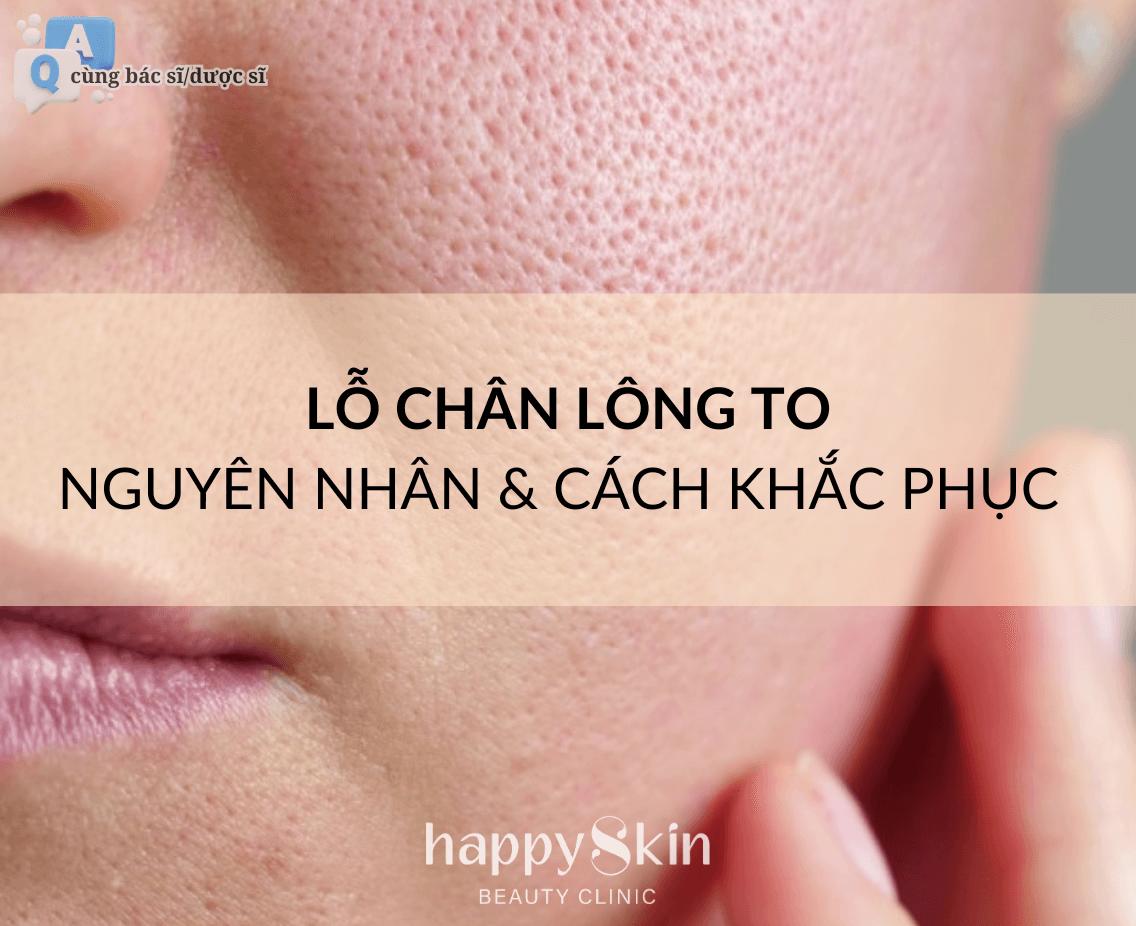 Làm Đẹp Cùng Bác Sĩ - Kỳ 4: Lỗ Chân Lông To? Nguyên Nhân Và Cách Se Khít Lỗ Chân Lông Hiệu Quả