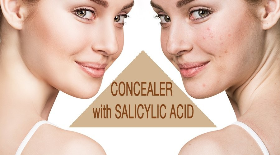 Kem che khuyết điểm chứa Salicylic Acid có thực sự tốt cho da mụn?