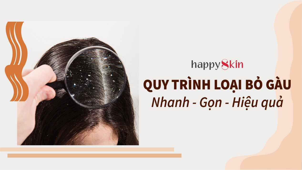 Bật mí 5 bước trị gàu “Nhanh – Gọn – Hiệu quả” đến từ các bác sĩ da liễu hàng đầu