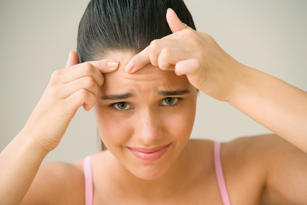 Có Thể Chữa Khỏi Mụn Đầu Đen Không?