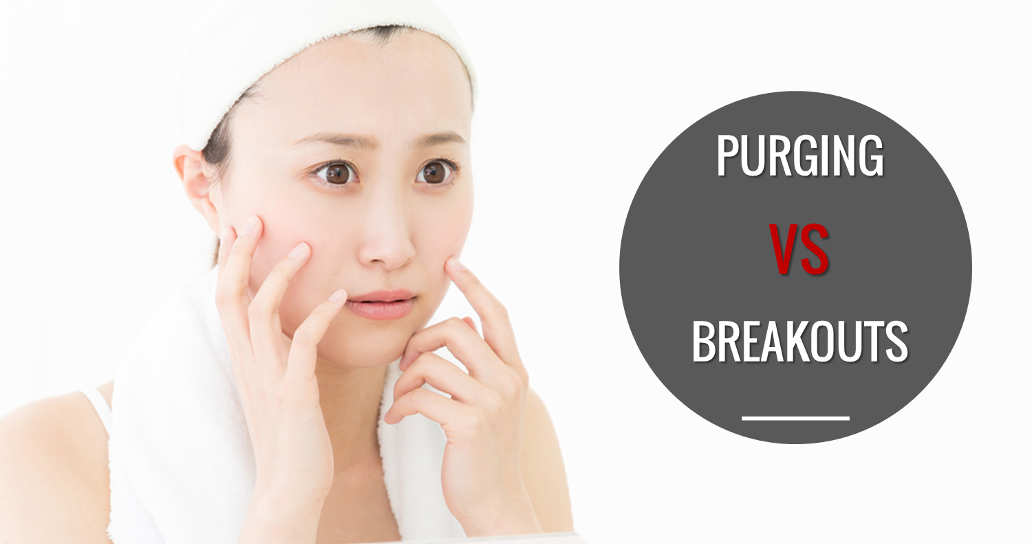 Đừng nhầm lẫn đẩy mụn với nổi mụn, kích ứng, dị ứng